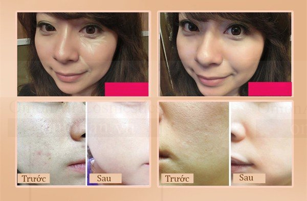 Kem Nền Chống Nắng Ốc S&ecirc;n Anjo Natural Cover Snail Sun BB SPF50+ PA+++